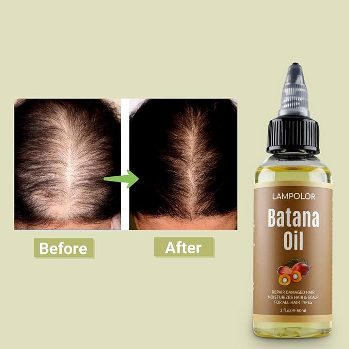 RAW Batana Oil for Hair Growth, Dr Sebi Organic Unrefined Batana Oil from Honduran, 100% Pure & Natural Hair Growth for Thicker & Stronger Hair - 4 FL OZ