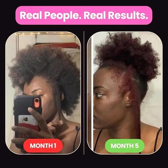 10 in 1 Hair Growth Oil (2 Oz) | Formulated With African Chebe Powder For Extreme Hair Growth, 2 Fl Oz (Pack of 1)