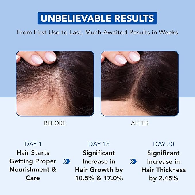 Botanic Hearth Hair Oil for Hair Growth | Rosemary Oil for Hair Growth with Biotin, Castor & Jojoba | Scalp Oil & Dry Scalp Treatment | Color Safe | All Hair Types | 4 Fl Oz