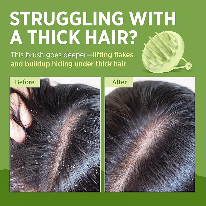 RoyceDerm Rosemary Mint Scalp Scrub Clarifying Scalp Exfoliator Refreshing Clean Scalp, Cooling Micro-Exfoliation with Botanical Extracts, For All Scalp Types (Rosemary Mint Scalp Scrub with Massager)