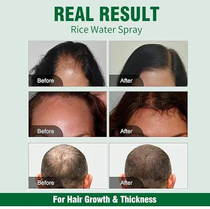 Natural Hair Growth Serum:Hair Growth Spray with Rosemary, Bataua Oil & Biotin - Non-Greasy, Hormone - Free Treatment,Promotes Thicker, Fuller Hair for Women & Men - All Thinning Hair (2 Fl Oz, FF)