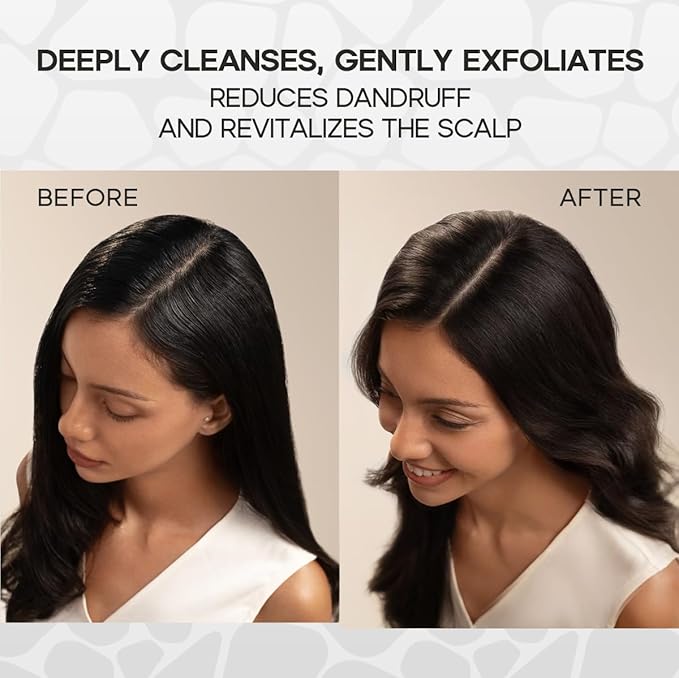 HALOVIDA Sea Salt Rosemary & Mint Scalp Scrub, Clean Silicon Oil-Free, Itchy Relief Scalp Treatment for Dandruff, Gently Exfoliator Cruelty-Free, Relieves Dryness, Promotes Hair Growth