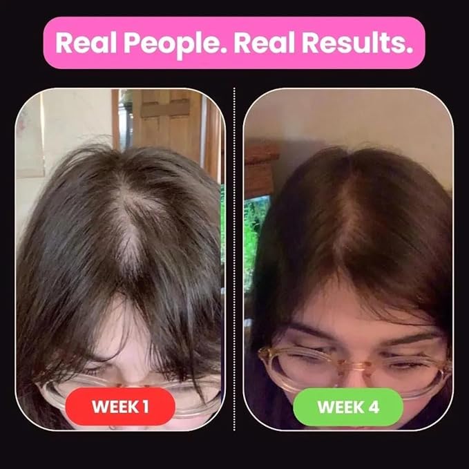 10 in 1 Hair Growth Oil (2 Oz) | Formulated With African Chebe Powder For Extreme Hair Growth, 2 Fl Oz (Pack of 1)