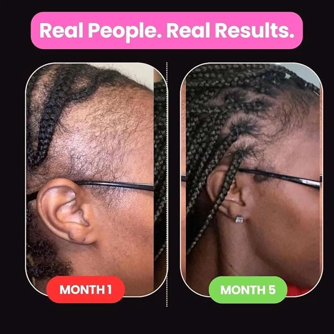 10 in 1 Hair Growth Oil (2 Oz) | Formulated With African Chebe Powder For Extreme Hair Growth, 2 Fl Oz (Pack of 1)