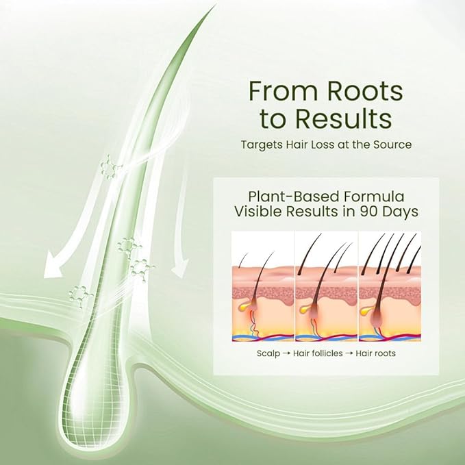 0.5% KX-826 DHT Blocker Hair Thickening Growth Products，Plant-Based Extract Essence Anti-Hair Loss Solution,Hair Spray,3 Days Oil Control 1-2 Weeks Hair Loss Reduction 3-6 Months New Hair Visible