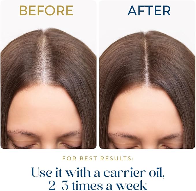 Rosemary Essential Oil for Hair - Huge 3.3 Fl Oz - 100% Pure - Premium Grade with Glass Dropper, Undiluted, Non-GMO