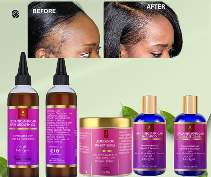 Chebe Hair Growth Oil, 52 in 1 Scalp stimulator for Rapid and Extreme Growth on bald spots, Edges. Thicknens Hair folicles in just couple uses. 5oz/150ml