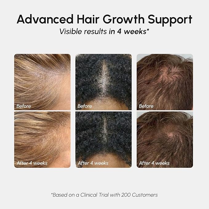 MAREE Hair Growth Spray – Caffeine, Batana, Castor & Rosemary Oil for Hair Growth – Products for Women & Men – Hair Oils for Hair Growth – Hair Thickening Spray for Roots – Hair Regrowth & Scalp Care