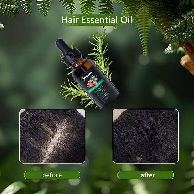 Tgideas Rosemary and Batana Oil Hair Oil Natural Plant Extracts - Nourishes Scalp and Strengthens Hair - Suitable for All Hair Types, Eyelashes and Eyebrows