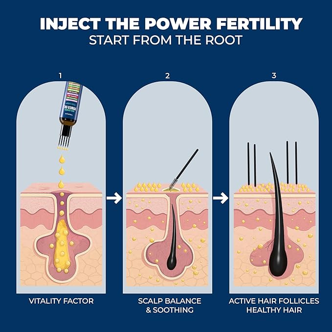 Rosemary Oil With Black Castor, Batana, Lavender, Coffee, Coconut, Argan, Avocado, Olive, Almond & Parsley Seed Oil, 11 Oils Infused for Ultimate Hair Growth (4 fl oz (120 ml))