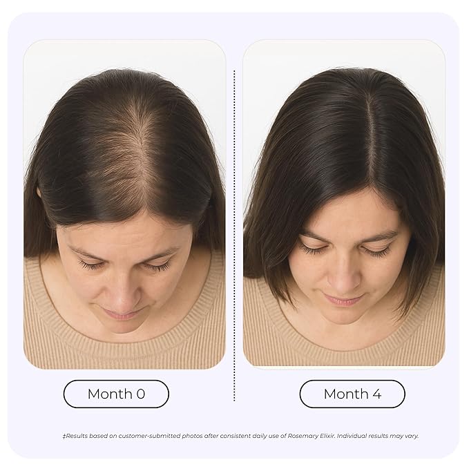 Rosemary Elixir – Daily Scalp Oil with 9 Essential Oils – Lightweight, Non-Greasy Formula for a Healthy-Looking Scalp – For Men & Women – 2oz