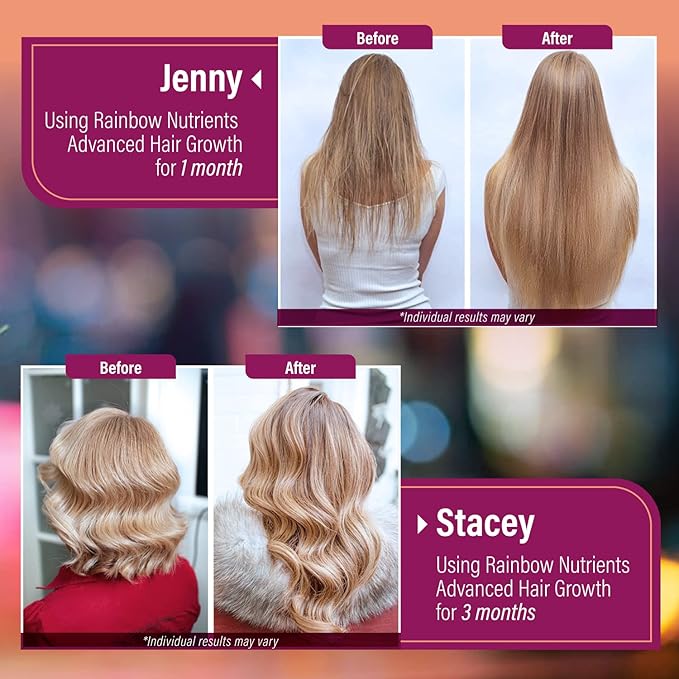 (2 Pack) Hair Growth Vitamins for Women | Biotin 10,000mcg, Collagen, Patented OptiMSM®, goMCT®, Saw Palmetto | Naturally Regrow Stronger & Healthier Hair, Skin and Nails | May Stop Hair Loss