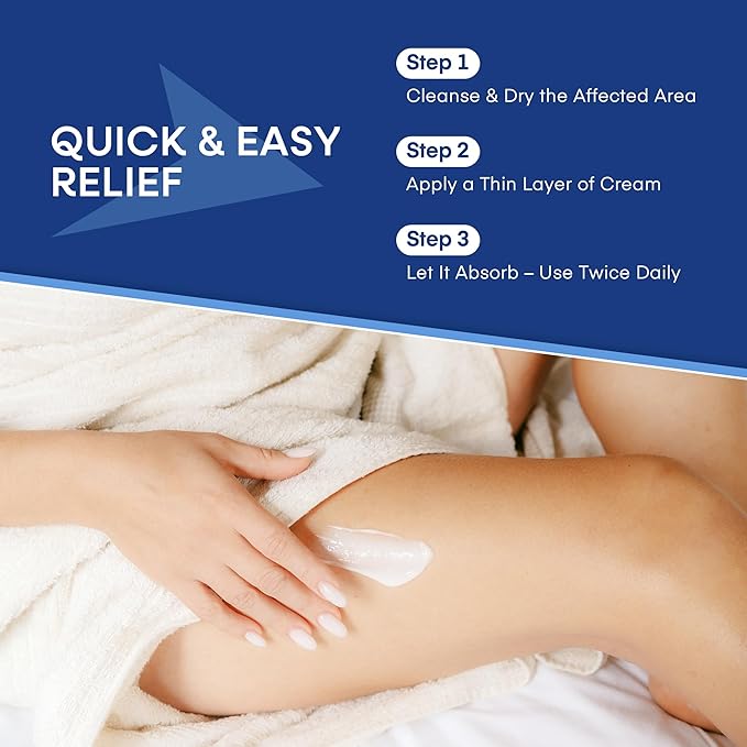 Hermon Seborrheic Dermatitis Scalp Treatment Cream: Soothing Itching Redness Scaling of Seborrheic Dermatitis - Fast-Acting Anti-Itch Ointment for Scalp Face Chest and Body for Men and Women 1 Pack