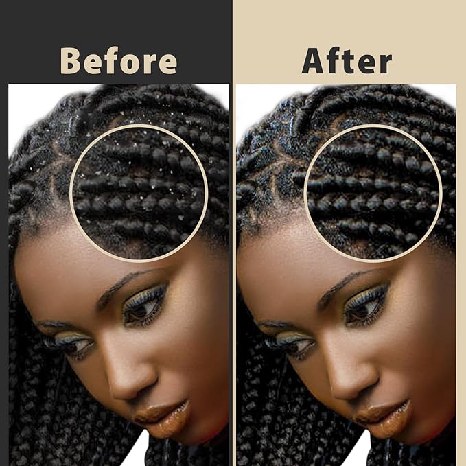 Rinse-Free Shampoo for Braid No Water Shampoo for Locs, Twists, Weaves, Dreadlock, Dry Spray for BuildUp, Odor, Itch& Flakes, No Residue Chemical Free- Cotton Pads Rounds for Briads, Scalp, Face Clean