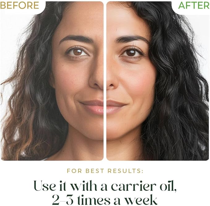 Tea Tree Essential Oil for Skin - Huge 3.3 Fl Oz - 100% Pure - Premium Grade with Glass Dropper, Undiluted, Non-GMO