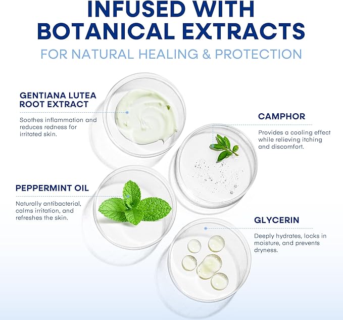 Hermon Seborrheic Dermatitis Scalp Treatment Cream: Soothing Itching Redness Scaling of Seborrheic Dermatitis - Fast-Acting Anti-Itch Ointment for Scalp Face Chest and Body for Men and Women 1 Pack