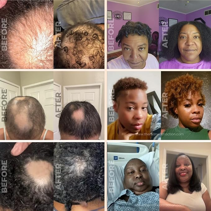 The Mane Attraction Hair Oil for All Hair Types, Infused with Rosemary Oil, Castor Oil & Black Seed Oil - Stimulating Hair Growth, Seals in Moisture, Soothes Irritated Scalp - 4 Fl Oz