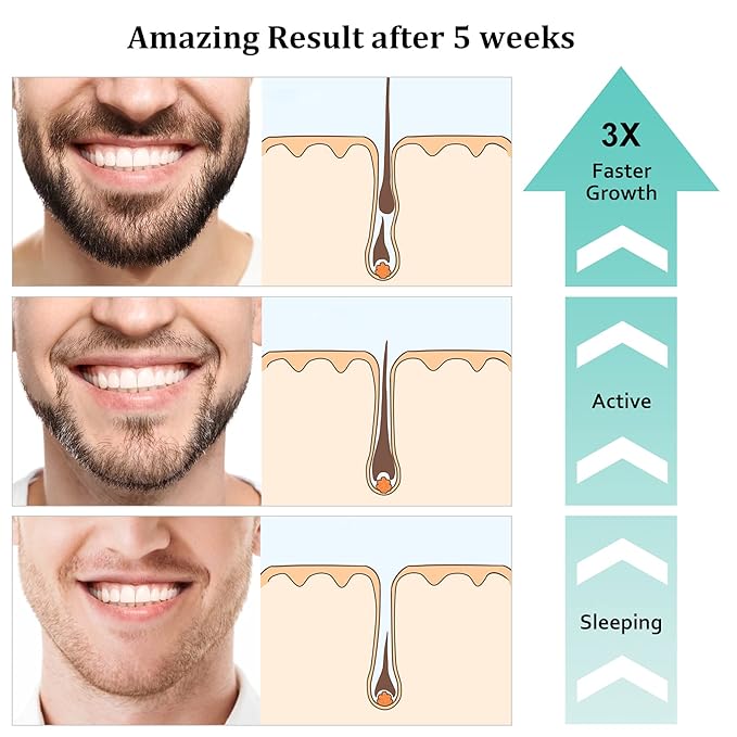 RAFFIN Beard Growth Kit, Upgraded Beard Growth Oil (2Oz) w/Maximum Thickening Biotin & Castor Oil for Spot/Patchy Beard, Achieve Fuller, Thicker & Healthier Beards, Gifts for Him Boyfriend Husband Dad