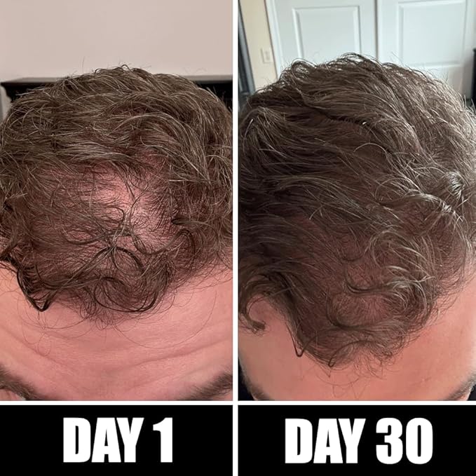 Pete & Pedro BOOST Hair & Beard Strengthening & Growth Natural Scalp Health Serum Oil For Men & Women - With Rosemary, Biotin & 20 plus Essential Oils | Shark Tank Featured, 2 oz.