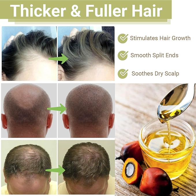 RAW Batana Oil for Hair Growth, Dr Sebi Organic Unrefined Batana Oil from Honduran, 100% Pure & Natural Hair Growth for Thicker & Stronger Hair - 4 FL OZ