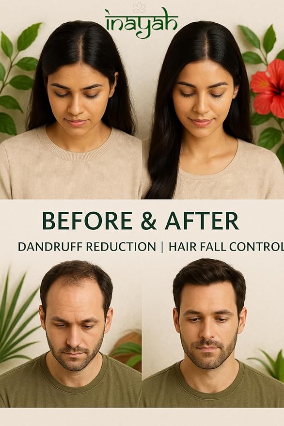 Inayah Ayurvedic Hair Oil for Hair Growth - 200ml | With Coconut Oil, Bhringraj, Amla, Hibiscus & 30+ Natural Herbs | Anti Hair Fall | Hair Regrowth Oil | No Fillers & Paraben Free