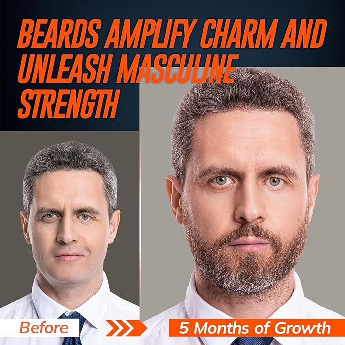 5% Minoxidil Beard Growth Serum for Men: 2-Pack Hair Regrowth Spray with Biotin & Rice Water - Extra Strength Beard Oil for Faster Thicker and Fuller Beard Growth - 4.06 Fl Oz