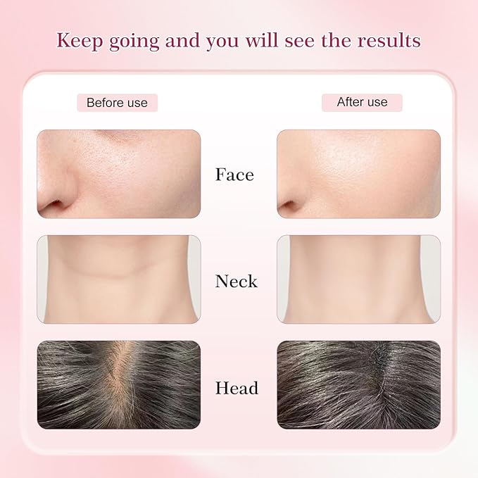 Multi-Functional-Red-Light-Therapy-for-Face and Neck-Eye-Head Massager,7 Colors Skin Rejuvenation Lifting Facial Massager for Toning,Glow Boost，Wrinkle&Dark Circle Reducer,Scalp Massager Hair Growth