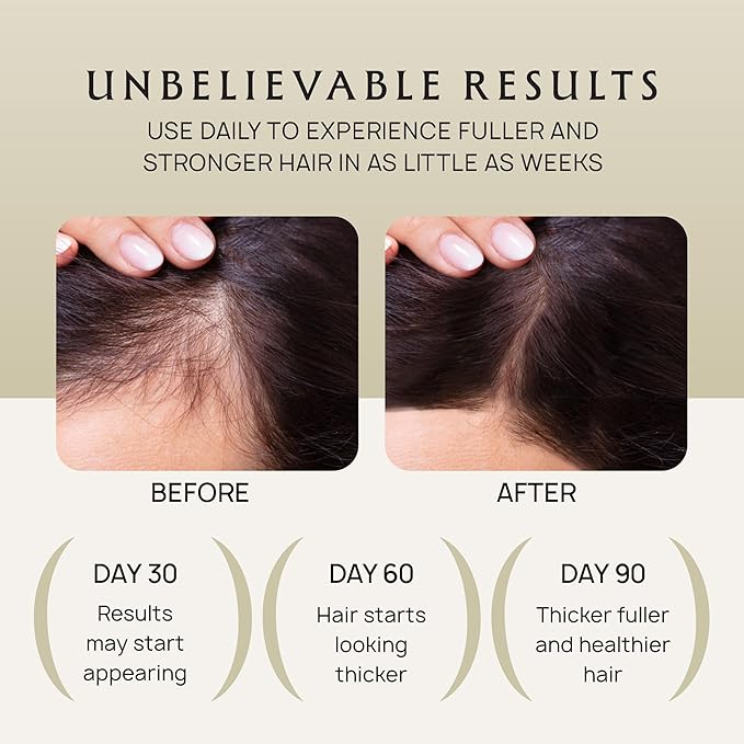 Hair Growth Oil Spray - 100% Pure Ingredients For Non Greasy, Thicker & Stronger Hair - Organic Batana, Castor, Biotin, Saw Palmetto, and Rosemary Oil Gifts Women Scalp (4.1 Fl Oz (Pack of 2))