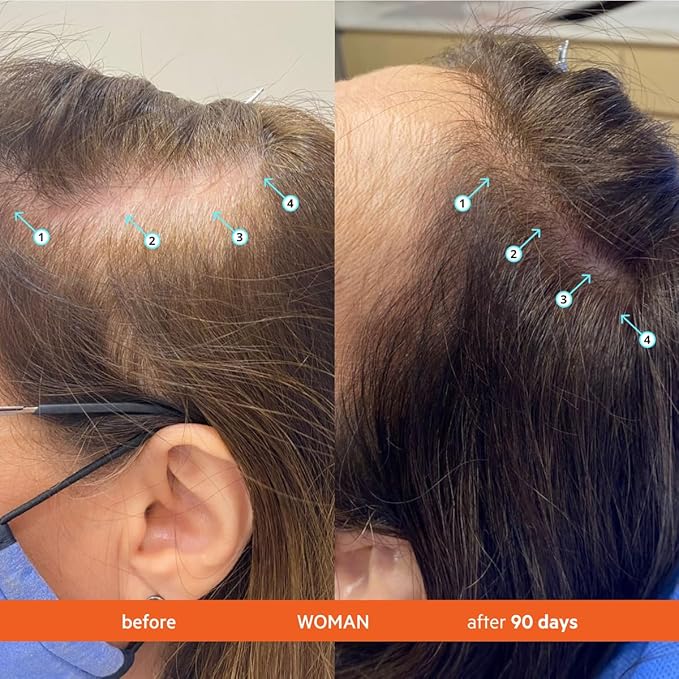 DS Labs Revita Shampoo, 100 mL – Scalp Refreshing Cleanse for Fuller Looking, Volumizing, Lightweight Hydration, Sulfate & Silicone Free, Color Safe, For Men & Women