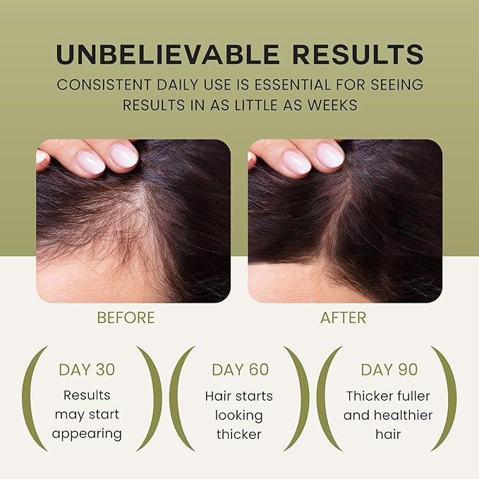 Batana Oil For Hair Growth - 100% Pure, Raw & Natural Blend With Organic Castor, Pumpkin Seed, Coconut and Rosemary Oil - Thicker, Stronger Hair Gifts For Men & Women Scalp (1 Pack)