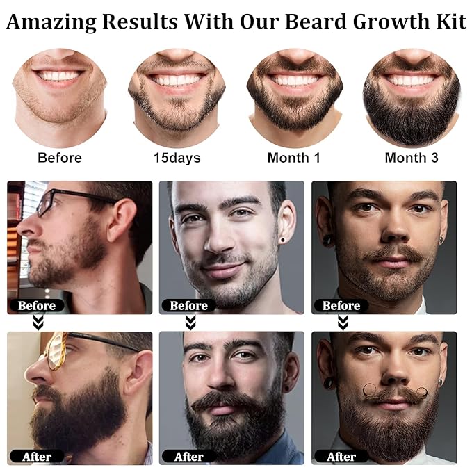 RAFFIN Beard Growth Kit, Upgraded Beard Growth Oil (2Oz) w/Maximum Thickening Biotin & Castor Oil for Spot/Patchy Beard, Achieve Fuller, Thicker & Healthier Beards, Gifts for Him Boyfriend Husband Dad