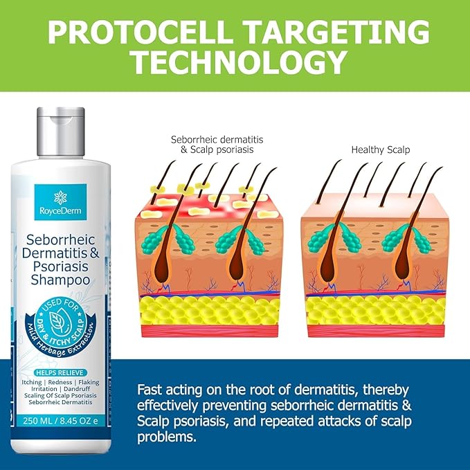 Roycederm Seborrheic Dermatitis & Psoriasis Shampoo with Scalp Massager Brush – Scalp Cleansing & Comfort Care Set for Dry, Itchy, Flaky Scalp, Dandruff & Buildup Support