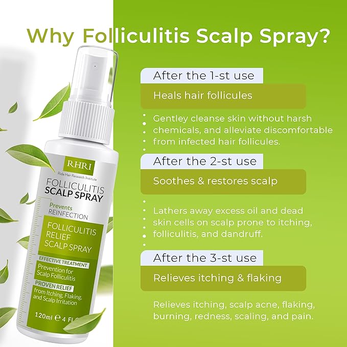 Folliculitis Scalp Spray | Dandruff Treatment for Psoriasis & Folliculitis | Antifungal & Anti Dandruff Itchy Scalp Treatment Formula Spray for Dry and Irritated Scalp