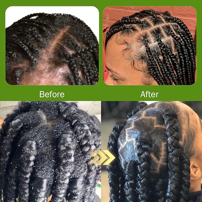No-Water Braid Shampoo for Locs, Twists, Weaves - Rinse-Free Dreadlock Shampoo for Build-Up, Odor, Itch- Rosemary Mint Butter Braid Balm Scalp Sleeping Balm for Dry Scalp Strengthens Hair Roots&Bonnet