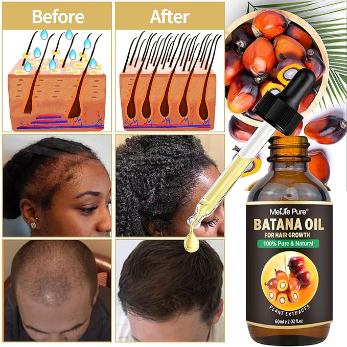 Batana Oil for Hair Growth–4Pc Set: Raw Batana Oil,Hair Mask Paste,Lash Wand & Brow Brush,Hair Growth Treatment Promotes Hair Thickness,Prevents Loss for Men Women,Deep Care for Scalp,Edges & Eyebrows