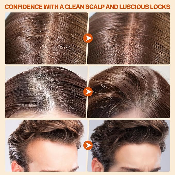 Scalp Scrub, Pumpkin Seed Oil Scalp Exfoliator With Biotin & Rosemary, Sulfate Free Scalp Detox for Itchy Scalp & Dandruff & Buildup Removal & Hair Growth, Hair Scrub with Scrubber