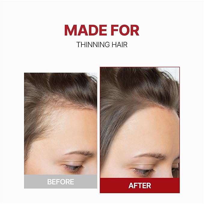 Kundal Caffeine Hair Loss Scalp Tonic - Soothes Scalp, Stimulates Hair Follicles, with Vitamin B3, Tea Tree & Peppermint Oil, Korean Hair care, 3.38 Fl Oz (100ml)