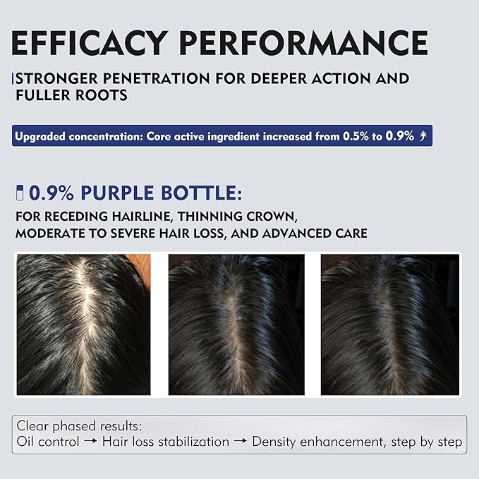 KINTOR 0.9% KX-826 DHT Blocker for Men & Women Hair Growth,Hair Growth Products Spray 60ml Pro