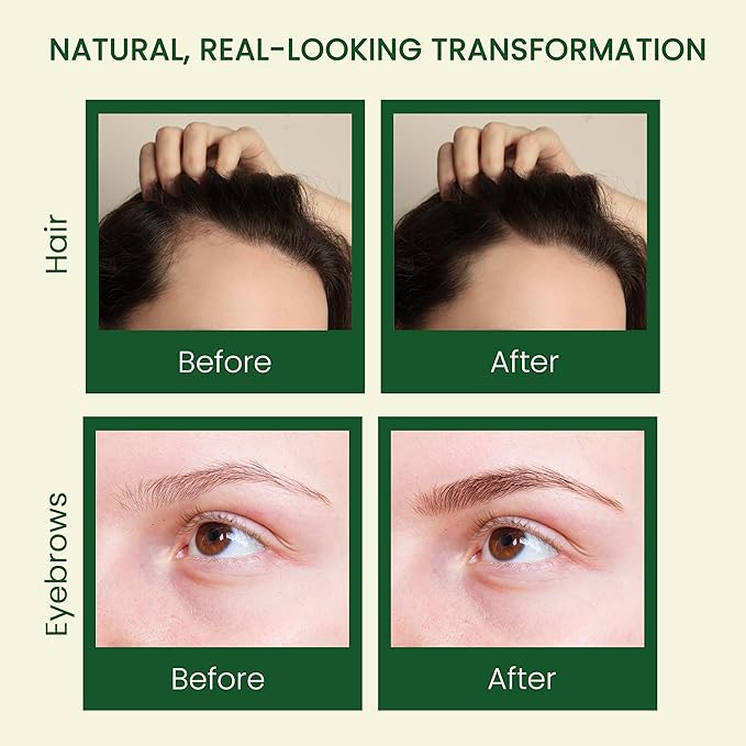 Pure Castor Oil - Cold Pressed 100% Castor Oil for Hair Growth, Skin, Eyebrows, Eye Lashes, Nails & Cuticles - Hexane Free, Natural & Unrefined - Includes Dual Mascara, Dropper & Scalp Massager