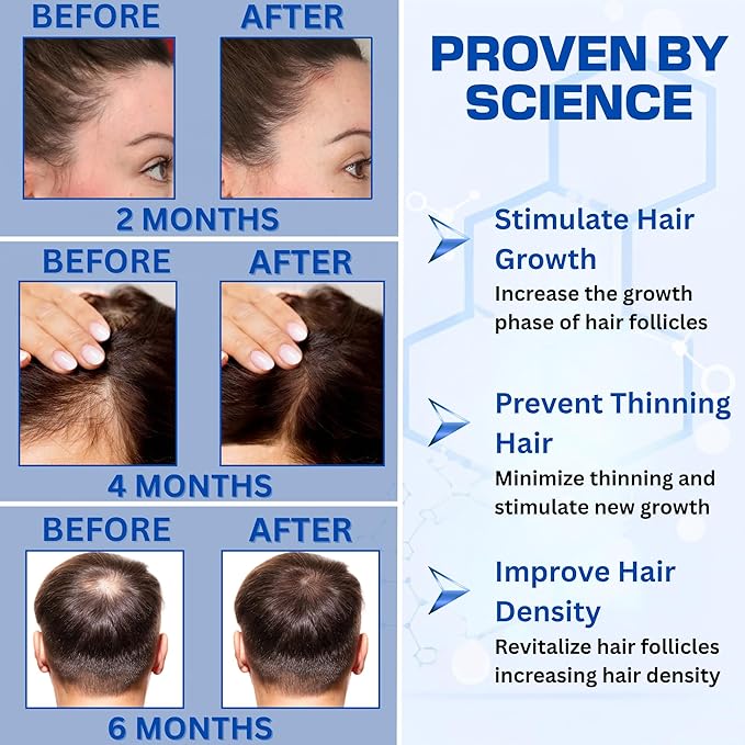 Copper Peptide Hair Serum – 10% GHK-Cu + 5% AHK-Cu Peptides for Hair Growth & Scalp Health – Advanced Regrowth Treatment for Thicker, Fuller Hair