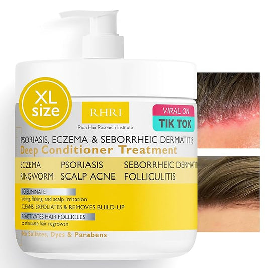 Anti Fungal Psoriasis Conditioner for Psoriasis, Eczema & Seborrheic Dermatitis | With DHT Blockers, Mineral Complex & Tea Tree Oil | Soothes Dry Itchy Scalp & Supports Hair Growth for Men & Women