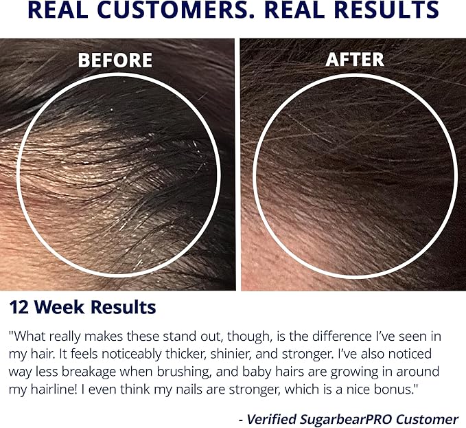 SugarBearPro Hair Vitamin Gummy 35 Day Supply, Extra Strength Biotin 6000mcg for Hair Growth, Vegan Vitamin B12, MSM, Inositol, Omega 3, Elderberry, Certified Kosher, Halal, Cruelty-Free