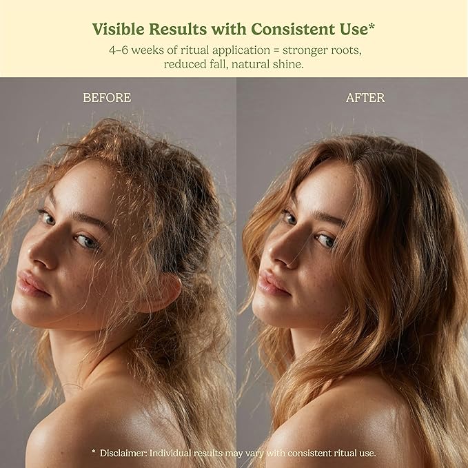 Organic Hair Growth Oil for Hair Fall, Dry Scalp & Thinning – Infused with 35+ Herbs including Bhringraj, Amla & Hibiscus | Nourishes & Supports Healthy Hair | Vegan & Toxin-Free | Ayurvedic