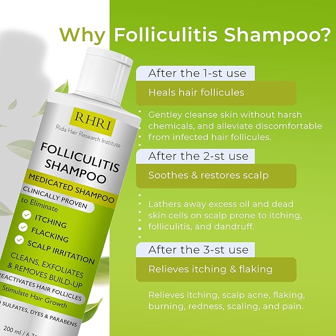 Anti Fungal Shampoo for Folliculitis, Seborrheic Dermatitis, Dandruff, Scalp Psoriasis & Itchy Dry Scalp Relief