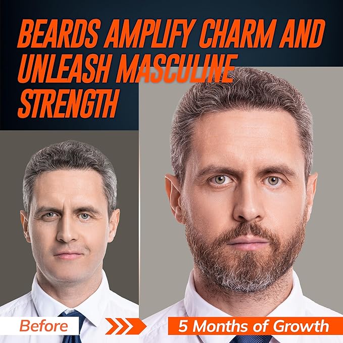 5% Minoxidil Beard Growth Serum for Men: Hair Regrowth Spray with Biotin & Rice Water - Extra Strength Beard Oil for Faster Thicker and Fuller Beard Growth - 60ML