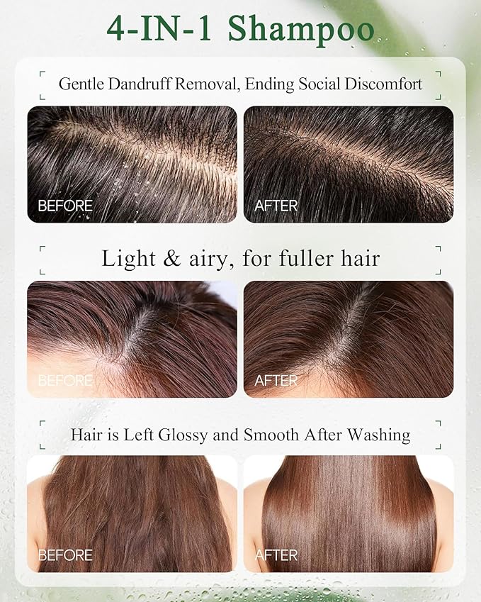 Mugwort Anti-Dandruff Shampoo – Oil-Control Refreshing formula, Soothes Itchy Scalp, Balance Scalp Barrier, Lightweight & Volumizing Hair, Silicone-Free, 10.1 fl oz