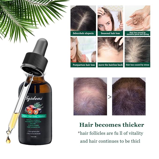 Tgideas Rosemary and Batana Oil Hair Oil Natural Plant Extracts - Nourishes Scalp and Strengthens Hair - Suitable for All Hair Types, Eyelashes and Eyebrows