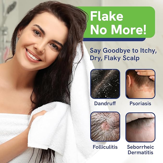 Sulfate Free Shampoo and Conditioner Set for Seborrheic Dermatitis Relief - Severe Dry & Itchy Scalp Treatment with Manuka Honey, Aloe Vera & Coconut Oil - Safe for Color Treated Hair (8 oz)