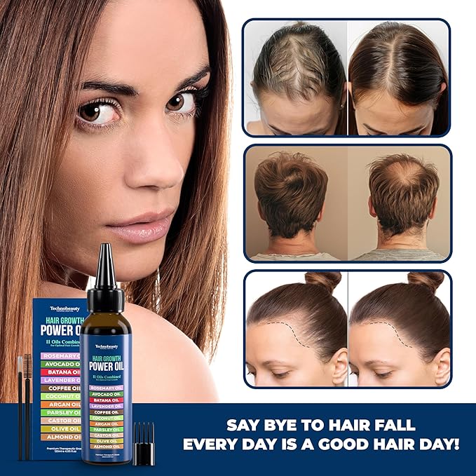 Rosemary Oil With Black Castor, Batana, Lavender, Coffee, Coconut, Argan, Avocado, Olive, Almond & Parsley Seed Oil, 11 Oils Infused for Ultimate Hair Growth (4 fl oz (120 ml))