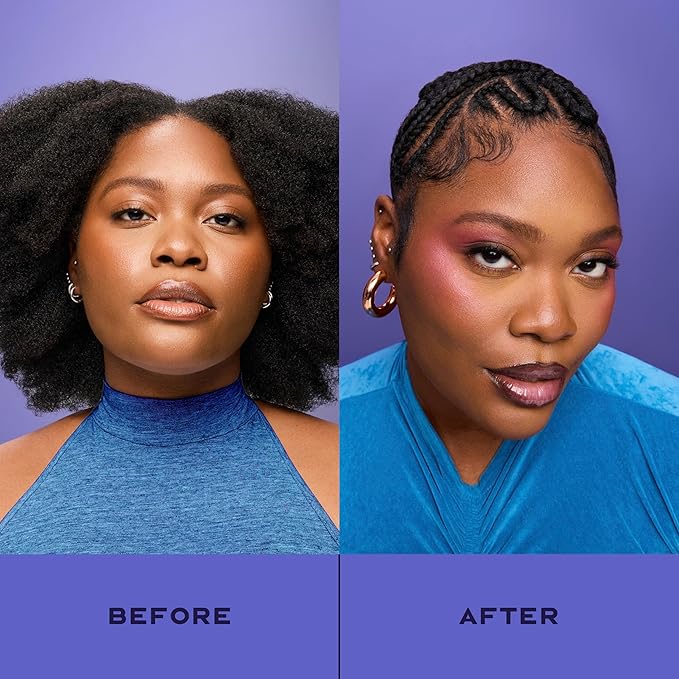 SheaMoisture Anti-Dandruff Leave-In Apple Cider Vinegar & Salicylic Acid To Soothe Scalp System for a Healthier Scalp 4 oz